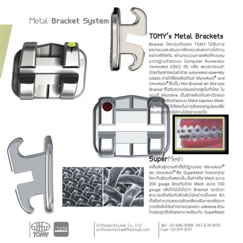 tomy orthodontics bracket